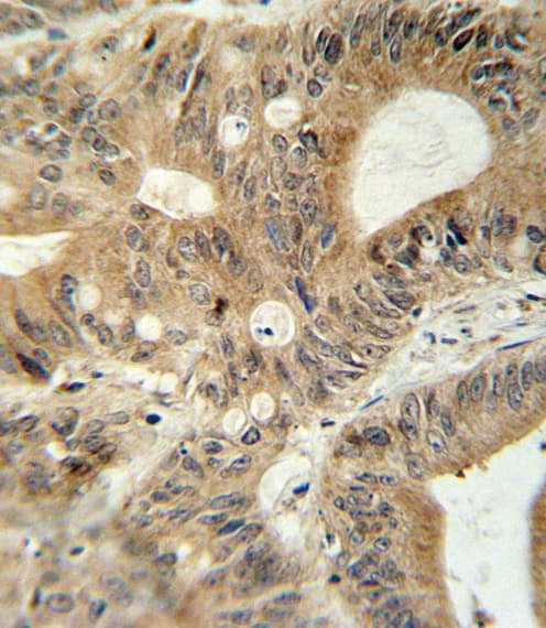 ABCC3 / MRP3 Antibody (aa899-925)