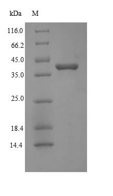 Human WNT2 / IRP Protein (Recombinant 6His, N-terminus)