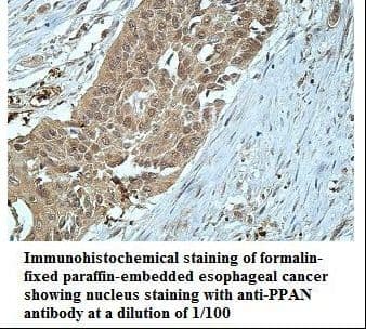 Polyclonal Rabbit anti-Human PPAN Antibody (aa184-307, IHC, WB)