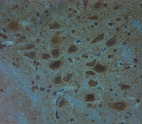 Polyclonal Rabbit anti-Human CLVS1 Antibody (aa300-354, IHC, WB)
