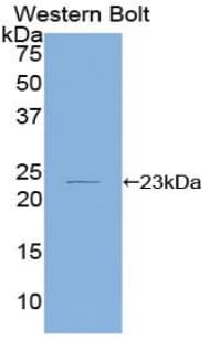 IL-1B / IL-1 Beta Antibody (aa63-247)