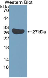 SOX18 Antibody (aa153-377, PE)