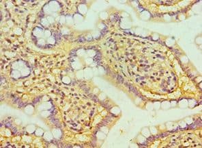 TIP30 / HTATIP2 Antibody (aa1-230)