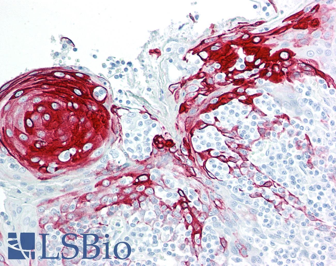 PathPlus™ KRT17 / CK17 / Cytokeratin 17 Antibody