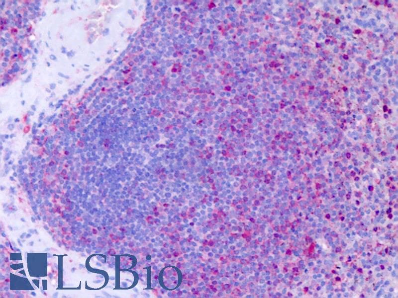IHC-plus™ Polyclonal Rabbit anti-Human ACKR4 / CCRL1 / CCR11 Antibody (Cytoplasmic Domain, IHC)