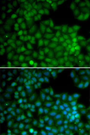 CDK7 Antibody