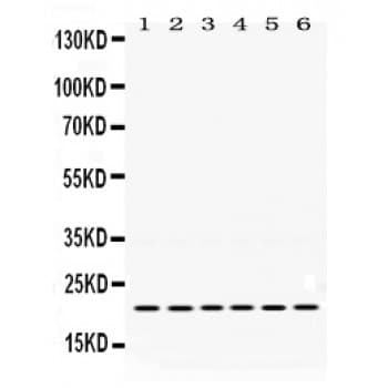 BIK Antibody (aa1-123)
