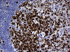 Monoclonal Mouse anti-Human MKI67 / Ki67 Antibody (clone OTI3B6, IHC)