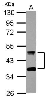 IHC-plus™ Polyclonal Rabbit anti-Human DNAJA4 Antibody (IHC, WB)