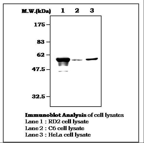 PathPlus™ Vimentin Antibody (clone 35E2)