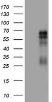 CD30 Antibody (clone OTI3F8)