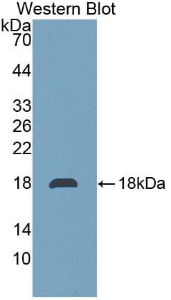 TMEM27 / Collectrin Antibody (aa15-141)