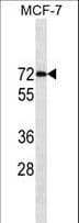 Monoclonal Mouse anti-Human ER Alpha / Estrogen Receptor Antibody (aa246-273, WB)