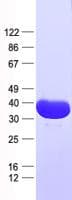 Human TIPIN Protein (Recombinant His, N-Terminal)