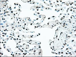 BRAF / B-Raf Antibody (clone OTI4C5)