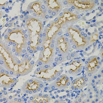 Polyclonal Rabbit anti-Human SLC30A1 / ZNT1 Antibody (IHC, WB)