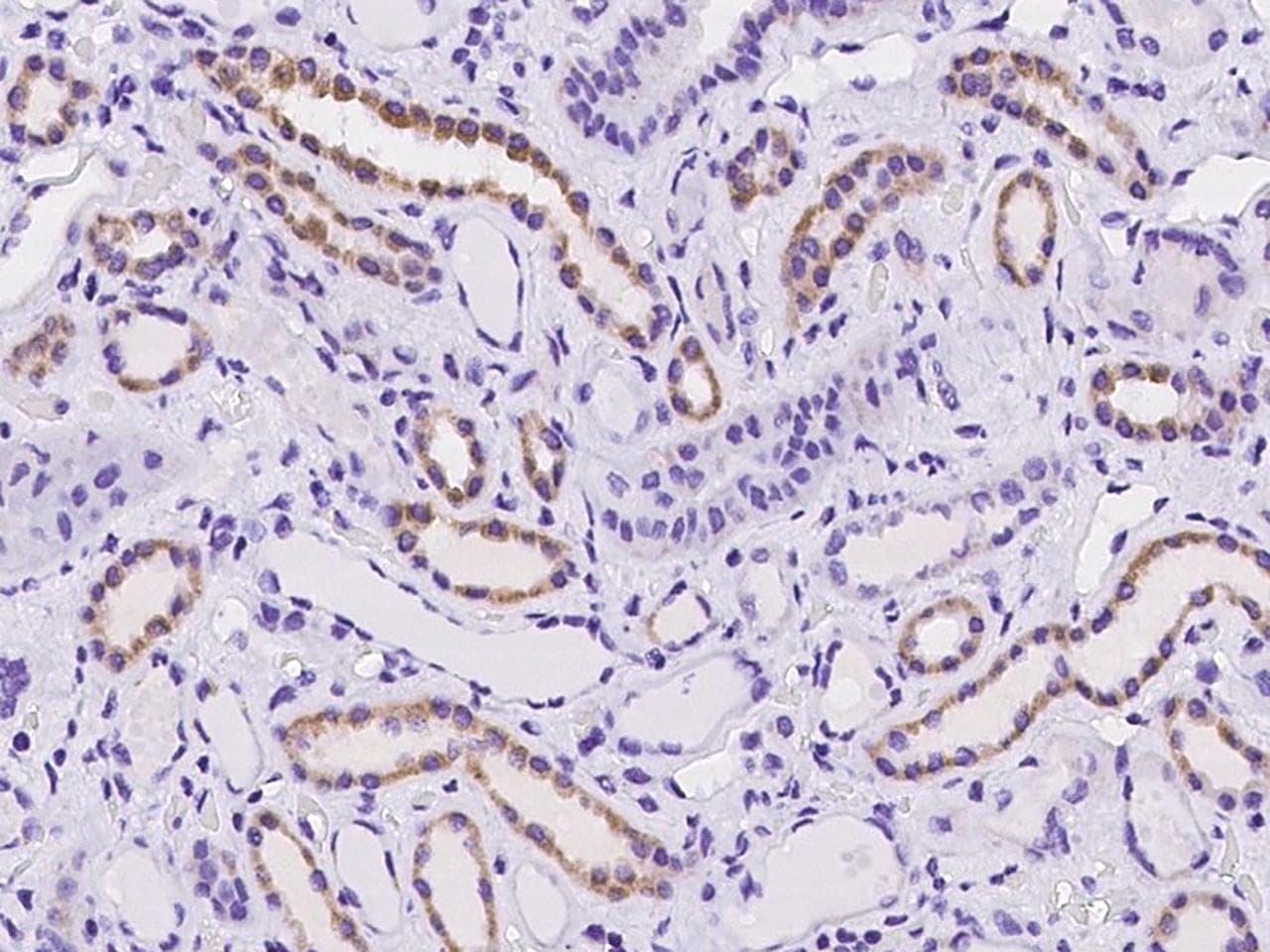 Polyclonal Rabbit anti-Human NDUFB9 Antibody (IHC)
