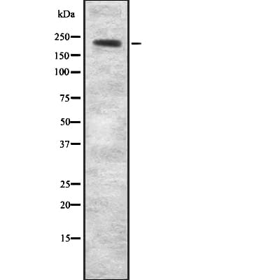 AKAP11 / KIAA0629 Antibody
