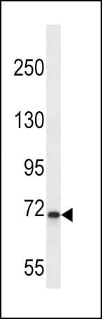 KLKB1 / Plasma Kallikrein Antibody (aa508-537)