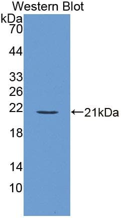 SLAMF7 / CRACC Antibody (aa23-175)