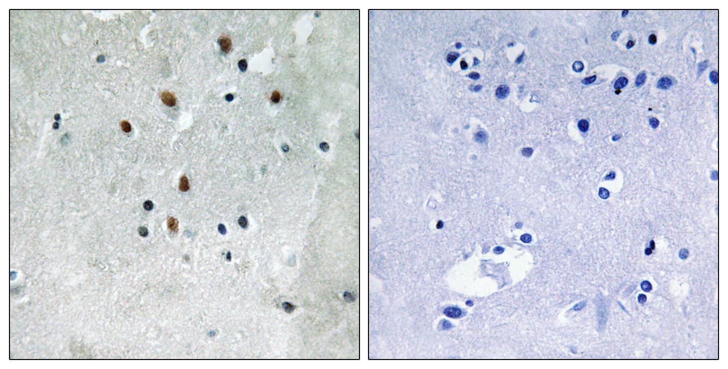 Polyclonal Rabbit anti-Human SRF / Serum Response Factor Antibody (phospho-Ser77, IHC, WB)