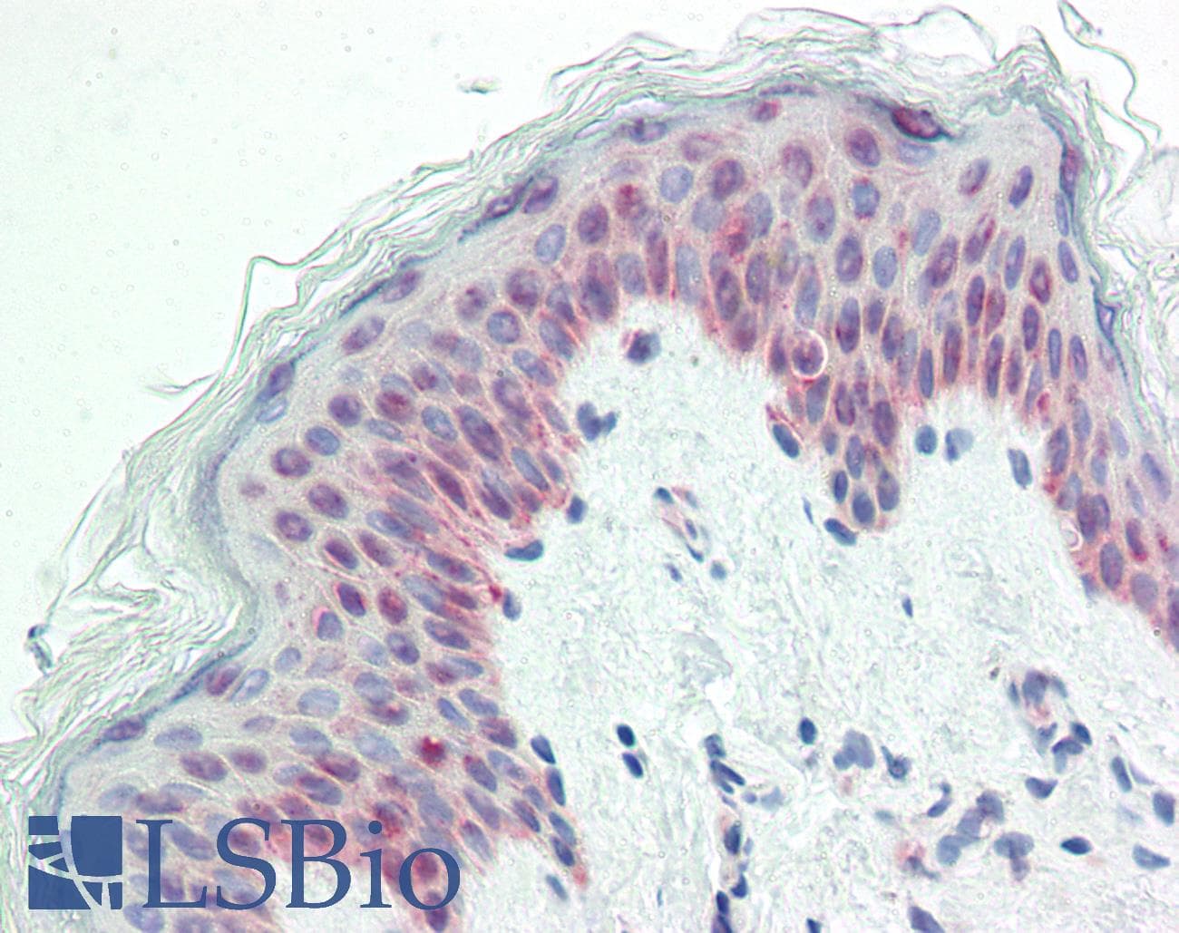 IHC-plus™ HNRNPH2 / hnRNP H2 Antibody (aa156-205)