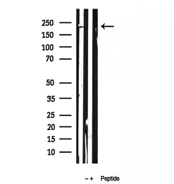 Polyclonal Rabbit anti-Human RB1CC1 / CC1 Antibody (IHC, WB)