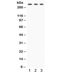 FASN / Fatty Acid Synthase Antibody