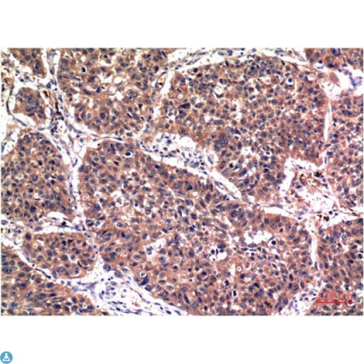 AKT1 Antibody