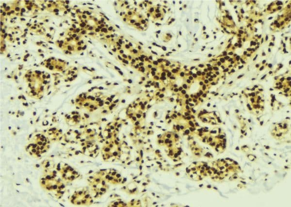 PRDM14 Antibody