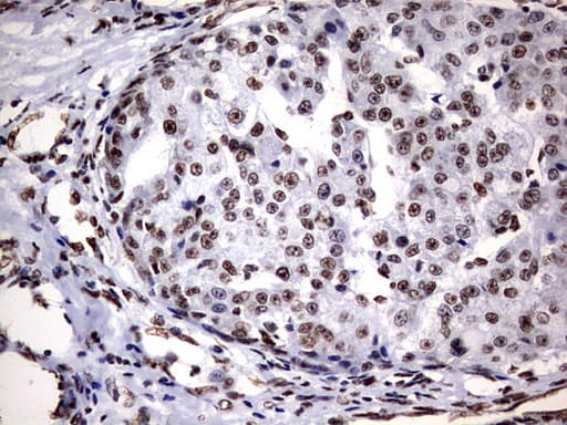 DDX56 Antibody (aa323-547, clone OTI11H7, Carrier-free)