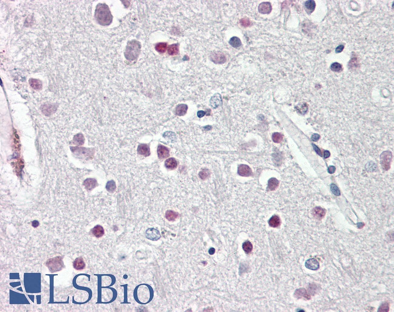 IHC-plus™ Polyclonal Goat anti-Human SOX3 Antibody (aa413-427, IHC, WB)