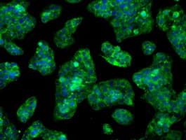 LOX / Lysyl Oxidase Antibody (clone OTI8G5)