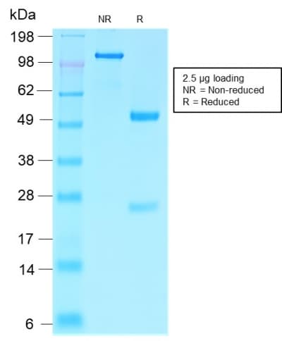 PathPlus™ Recombinant Monoclonal Rabbit anti-Human VIL1 / Villin Antibody (clone VIL1/2310R, aa179-311, IHC)