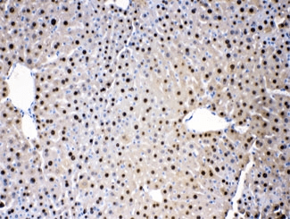 ADK / Adenosine Kinase Antibody