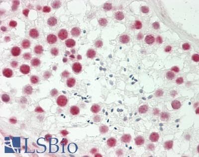IHC-plus™ TROP2 / TACSTD2 Antibody (Internal)