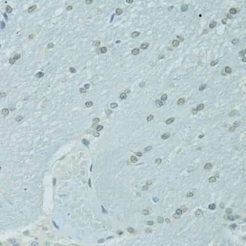 C/EBP Alpha / CEBPA Antibody
