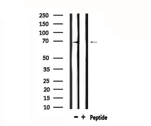 Polyclonal Rabbit anti-Human IRAK2 / IRAK-2 Antibody (IF, WB)