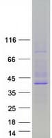 Human P450SCC / CYP11A1 Protein (Recombinant Myc-DDK (Flag))