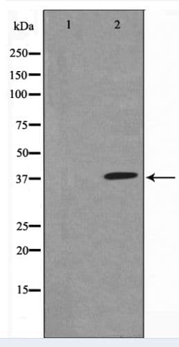 Polyclonal Rabbit anti-Human NFKBIA / IKB Alpha / IKBA Antibody (IHC, WB)