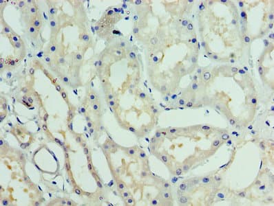 Polyclonal Rabbit anti-Human GTF2H5 Antibody (WB)