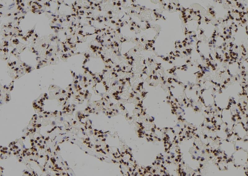 ZCCHC17 / PNO40 / PS1D Antibody