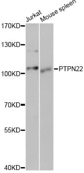 PTPN22 / PEP Antibody