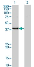 UROD Antibody (clone 1G4)