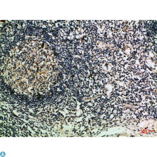 Polyclonal Rabbit anti-Human GZMM / Granzyme M Antibody (WB)
