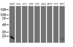 CST3 / Cystatin C Antibody (clone OTI1A6)