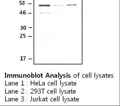 IHC-plus™ Polyclonal Rabbit anti-Human TRXR1 / TXNRD1 Antibody (IHC, WB)