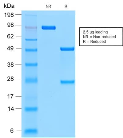 EMA / MUC1 Antibody (clone MUC1/2278R)