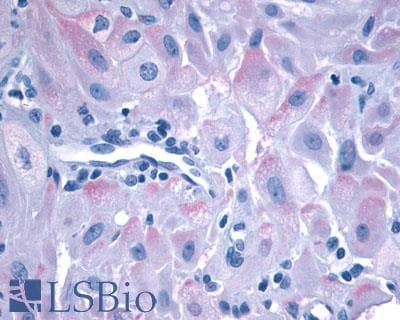 PathPlus™ Polyclonal Rabbit anti-Human OXTR / Oxytocin Receptor Antibody (N-Terminus, IHC)
