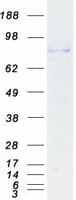 Human HLCS / HCS Protein (Recombinant Myc-DDK (Flag))
